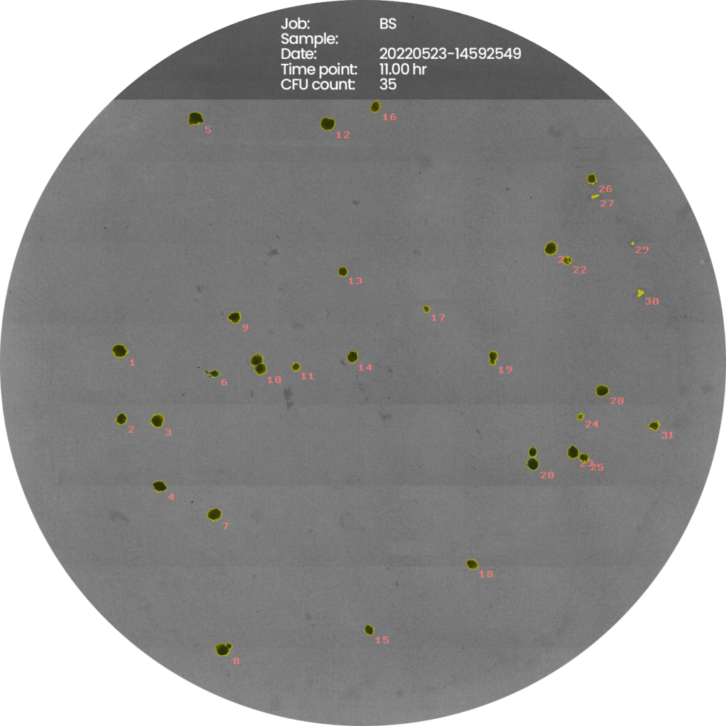 Bacillus-subtilis-new