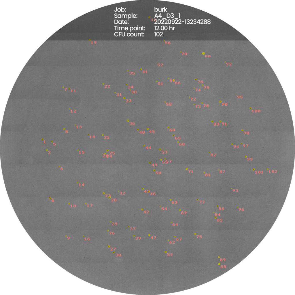 Burkholdria-cepacia-new