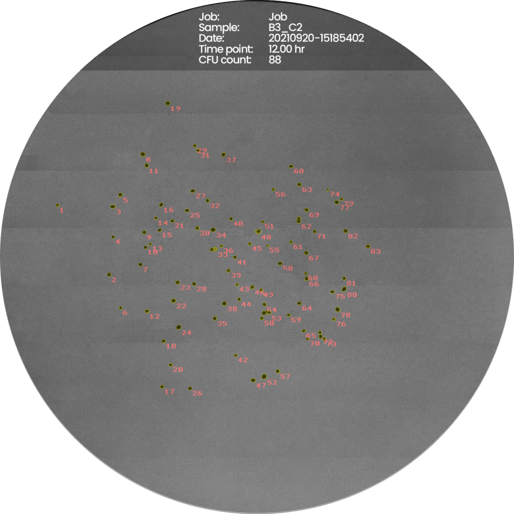 Micrococcus-Luteus-new