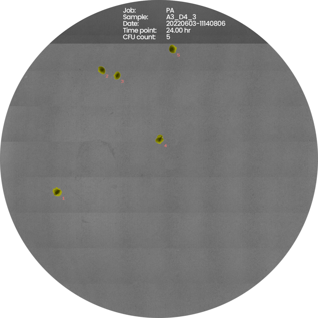 Pseudomonas-Aeruginosa-new