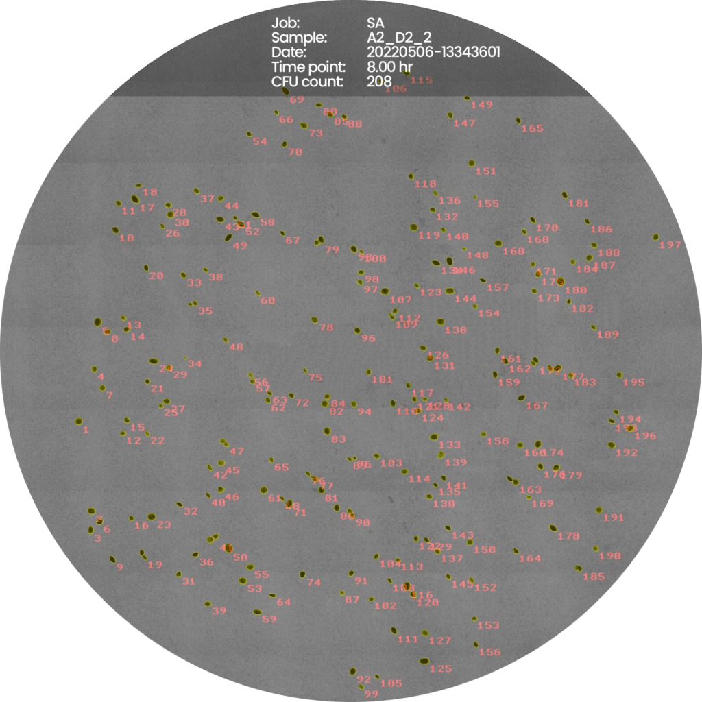 Staphyloccus-Aeureus-new